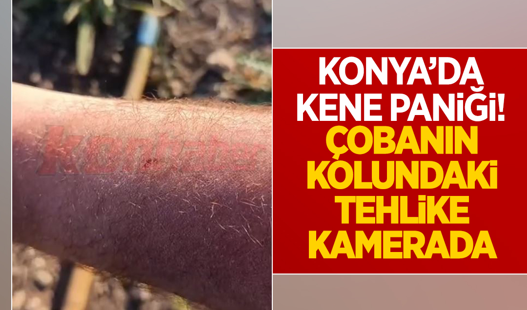 Konya’da kene paniği! Çobanın kolundaki tehlike kamerada